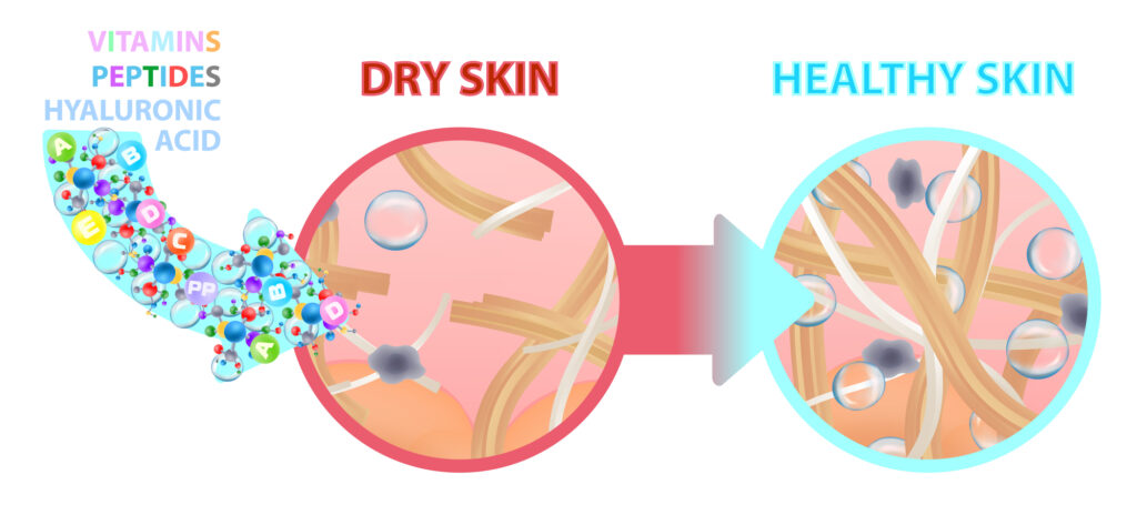 Hyaluronic acid in skincare